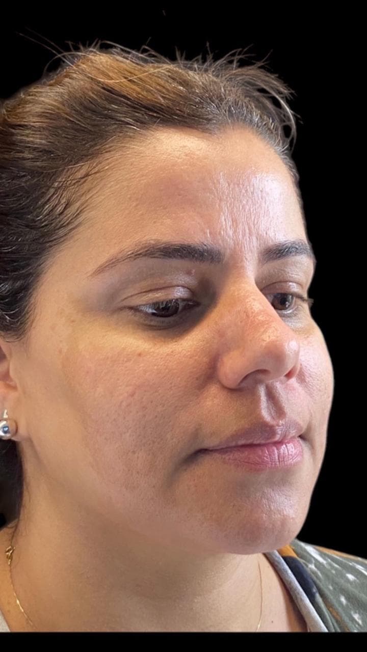 Face before treatment